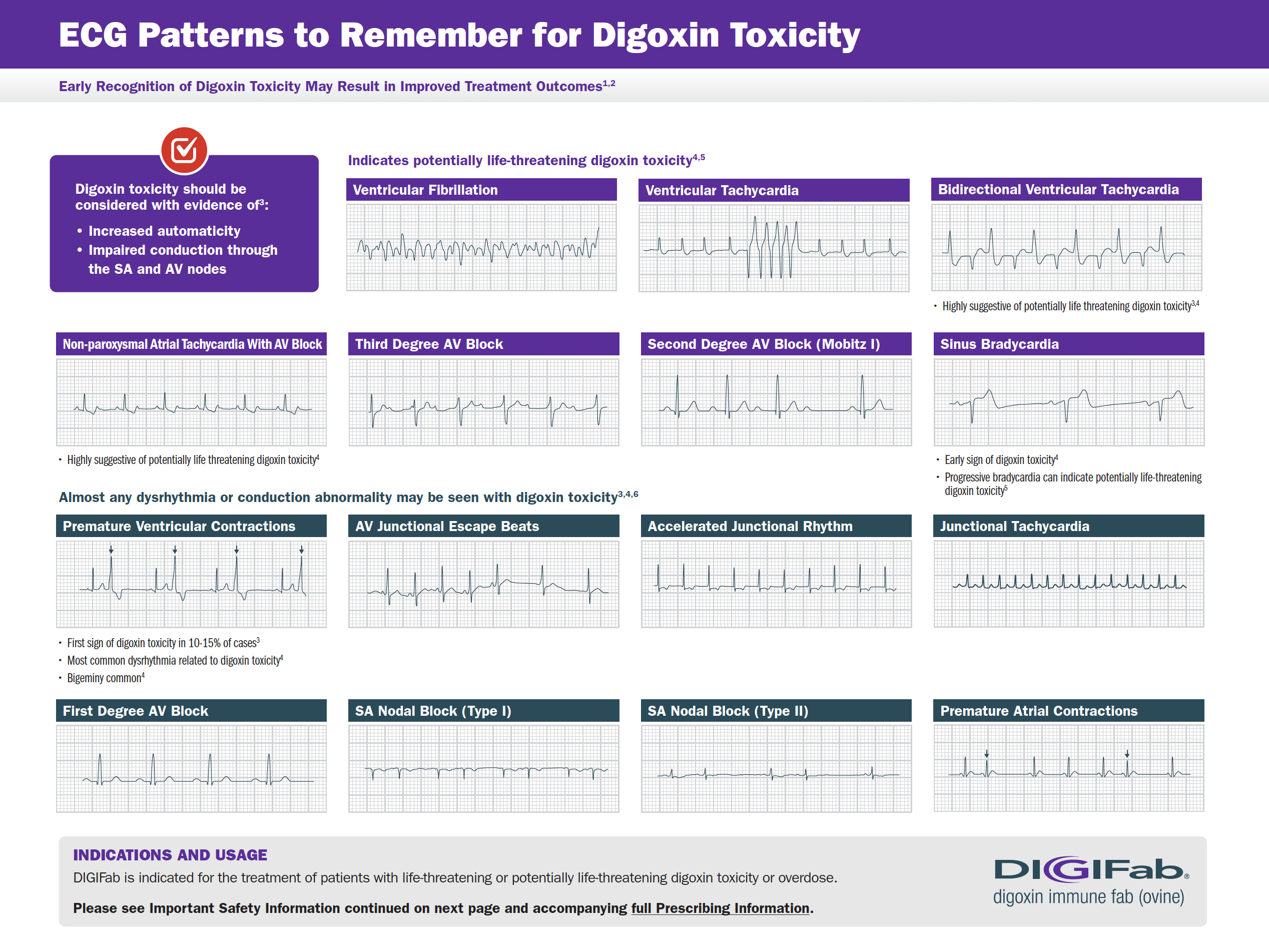 digoxin toxicity ecg reference tool image